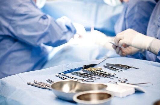 Hirurška intervencija u hroničnom prostatitisu